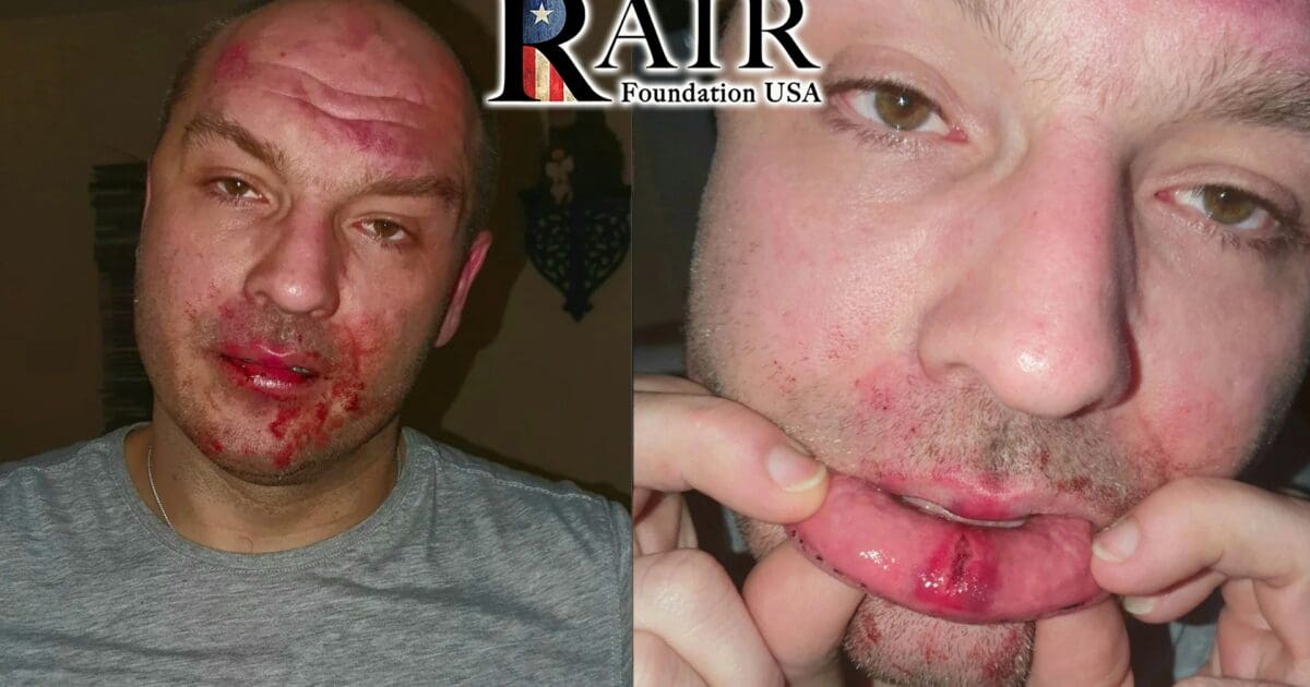 Germany: AfD Politician Severely Beaten by 'Foreigners' in Another Politically Motivated Attack - RAIR